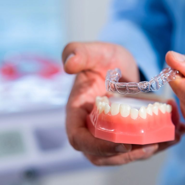 Close-up. The doctor puts transparent aligners on the teeth of the artificial jaw